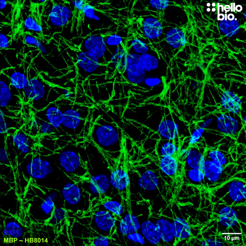 Figure 8. Myelin Basic Protein staining in rat brain. Mounted using MightyMount<sup>TM</sup> Antifade Fluorescence Mounting Medium with DAPI (aqueous).