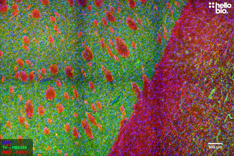 Figure 6. Tyrosine Hydroxylase and Myelin Basic Protein staining in rat striatum. Mounted using MightyMount<sup>TM</sup> Antifade Fluorescence Mounting Medium with DAPI (aqueous).