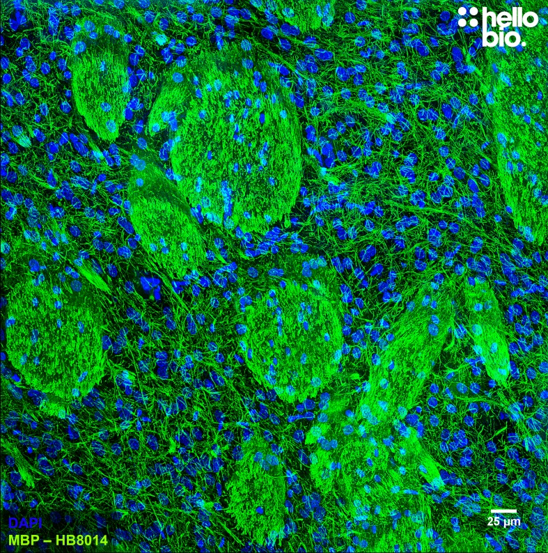 Figure 3. Myelin Basic Protein staining in rat striatum. Mounted using MightyMount<sup>TM</sup> Antifade Fluorescence Mounting Medium with DAPI (aqueous).