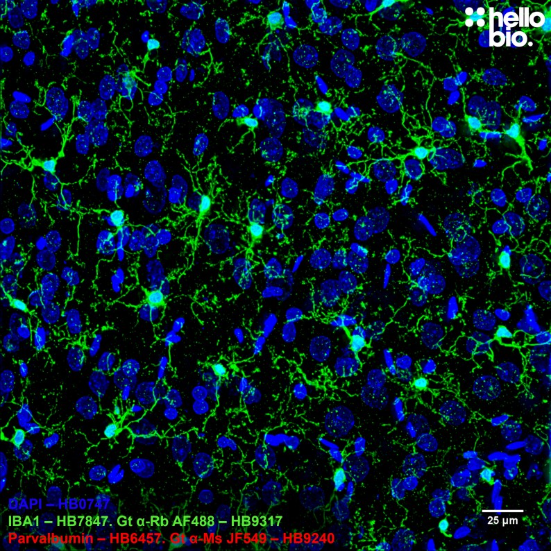 Figure 5. IBA1 staining in the hippocampal region of rat brain using HB7847 and HB9317 Goat Anti-Rabbit H&L (AF488) 