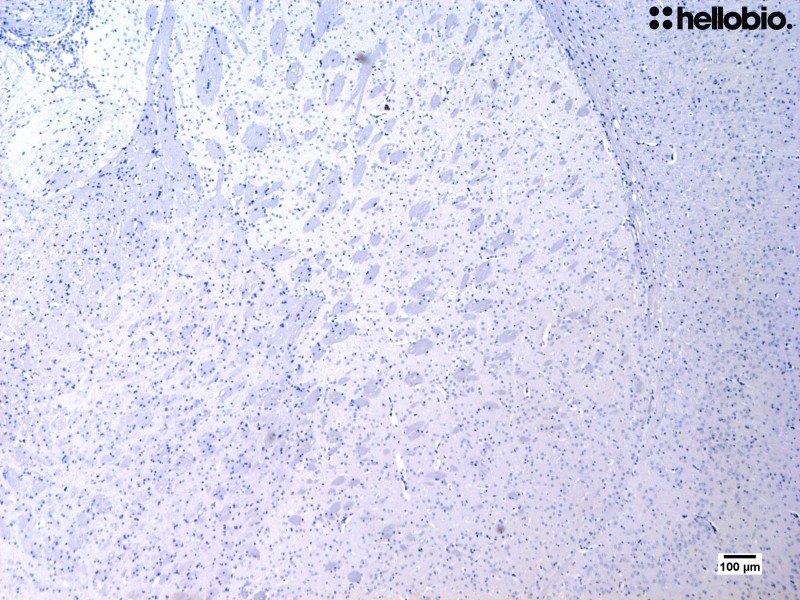 Figure 1. Hematoxylin staining in mouse striatum