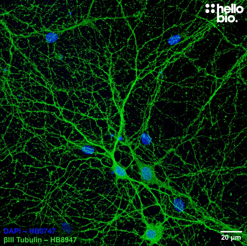 Figure 2. βIII tubulin staining with HB8947 of cultured rat hippocampal neurons.