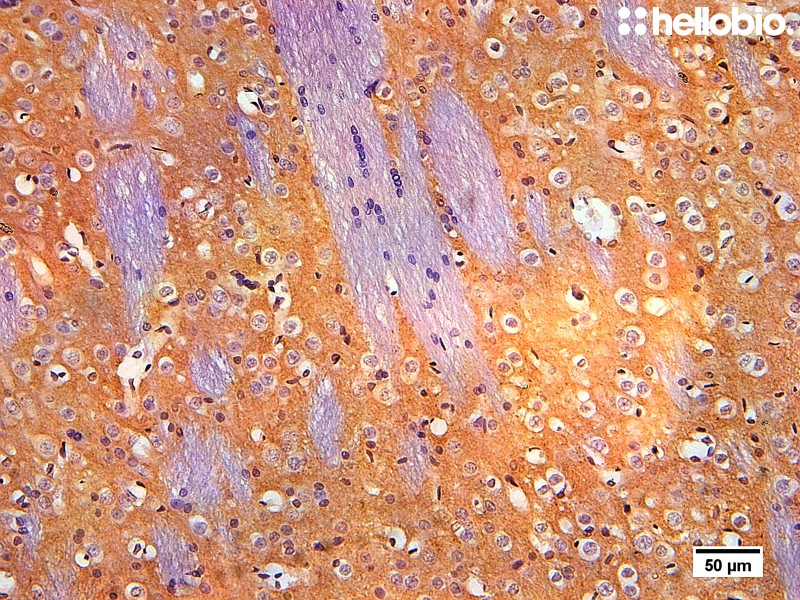 Figure 6. Tyrosine hydroxylase staining in rat striatum visualized using biotin-streptavidin detection.