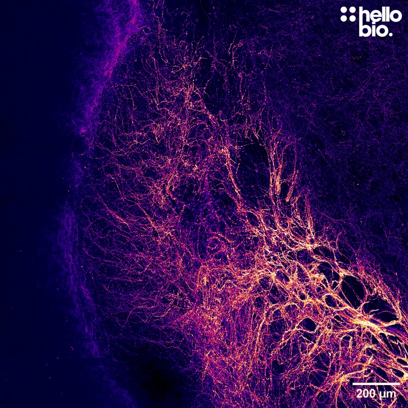 Figure 3. Cleared mouse brain lobe stained for tyrosine hydroxylase showing dopaminergic projections towards the striatum