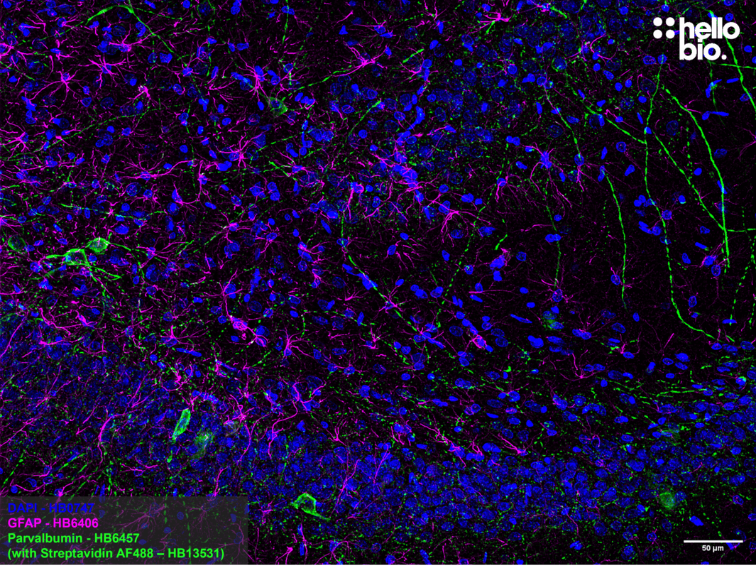 Figure 7. Parvalbumin expressing interneurons and GFAP positive astrocytes in the rat hippocampus.