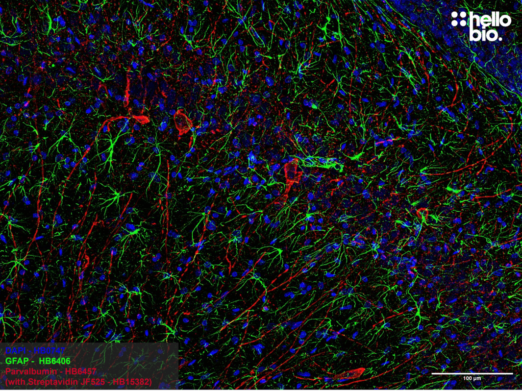 Figure 3.  Parvalbumin expressing interneurons and GFAP expressing astrocytes in the rat hippocampus