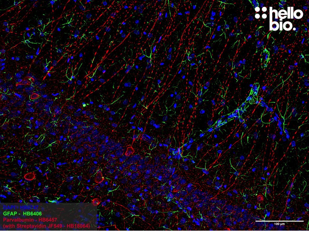 Figure 5. Parvalbumin positive interneurons and GFAP positive astrocytes in the rat hippocampus.