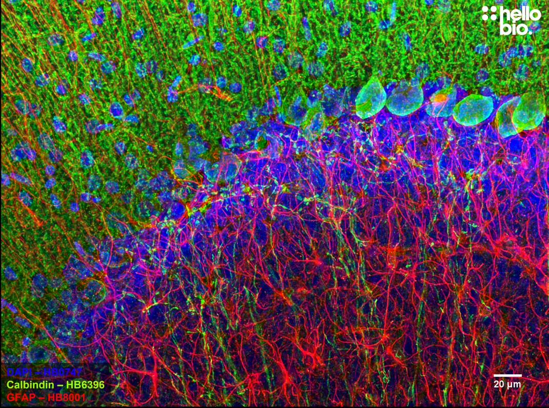 Figure 2. Calbindin and GFAP staining in the cerebellum. Mounted using MightyMount<sup>TM</sup> Antifade Fluorescence Mounting Medium with DAPI (hardset).