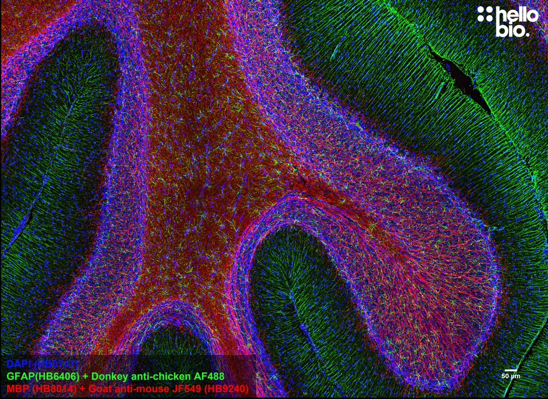 Figure 2. MBP staining in rat cerebellum using HB9240 Goat Anti-Mouse IgG H&L (Janelia Fluor® 549) preadsorbed secondary antibody.