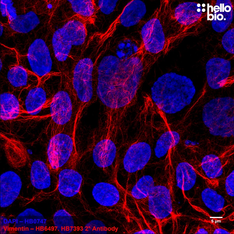 Figure 3. Vimentin expression in HEK293T cells visualised using HB6497 and HB7393 Goat Anti-Mouse H&L (Janelia Fluor® 646).