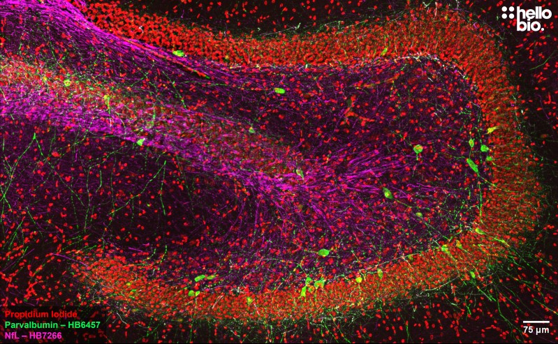 Figure 8. Parvalbumin and Neurofilament L staining in rat dentate gyrus. Mounted using MightyMount<sup>TM</sup> Antifade Fluorescence Mounting Medium with Propidium Iodide (aqueous).