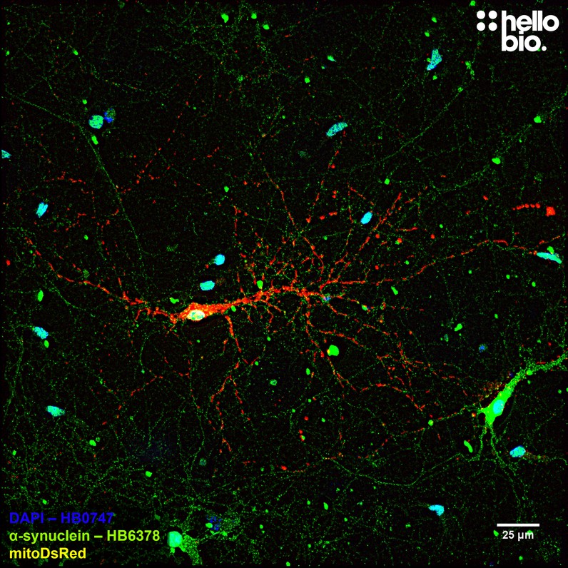 Figure 7. α-Synuclein staining in mitoDsRed transfected cultured rat hippocampal neurons.