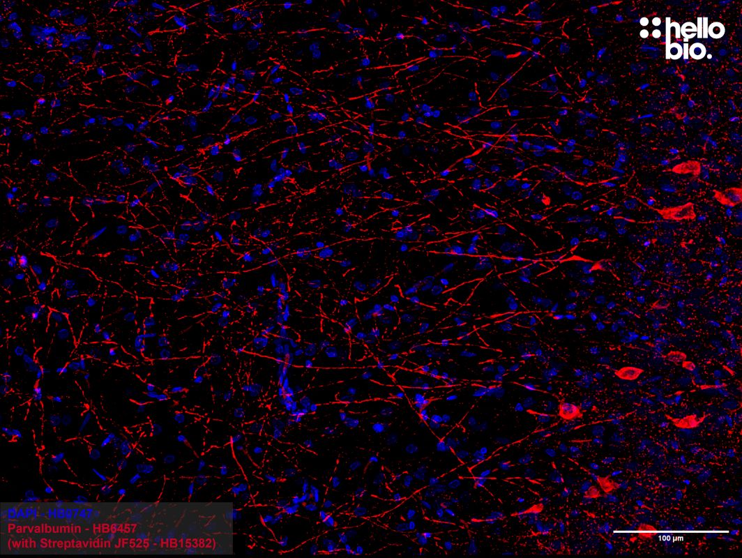 Figure 4: Streptavidin Janelia Fluor® 525 (HB15382) detection of parvalbumin positive interneurons in the rat hippocampus