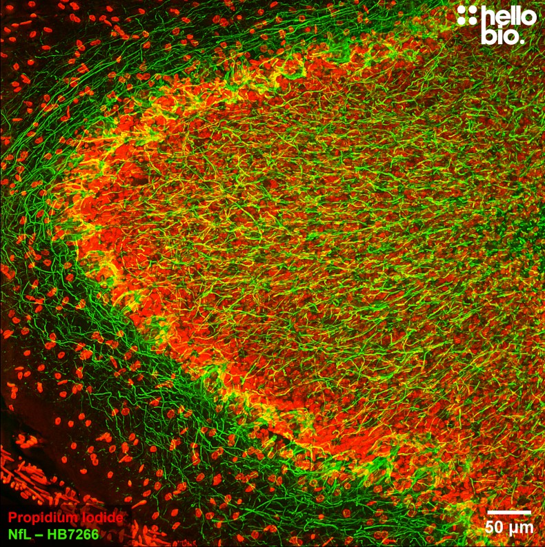 Figure 9. Neurofilament L staining in rat dentate gyrus. Mounted using MightyMount<sup>TM</sup> Antifade Fluorescence Mounting Medium with Propidium Iodide (aqueous).