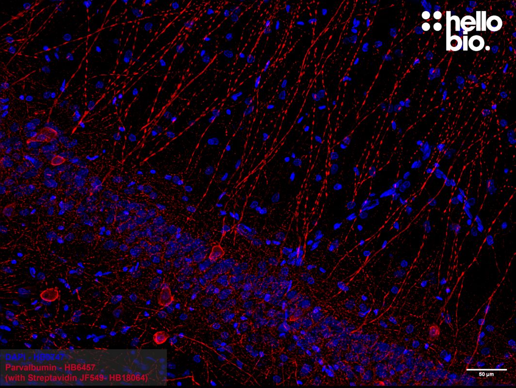 Figure 1: Parvalbumin positive interneuron cells in the rat hippocampus.