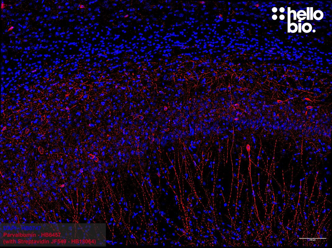 Figure 3. Parvalbumin positive interneuron populations in the rat hippocampus