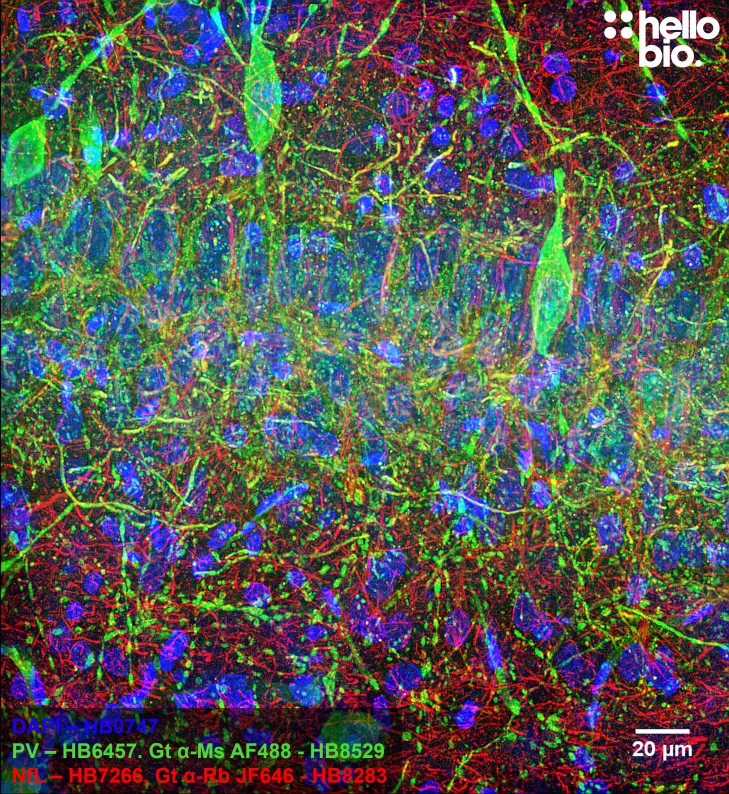 Figure 1. Parvalbumin and Neurofilament L and staining in rat CA1 using HB8529 Goat Anti-Mouse H&L (AF488) and HB8283 Goat Anti-Rabbit H&L (Janelia Fluor® 646)