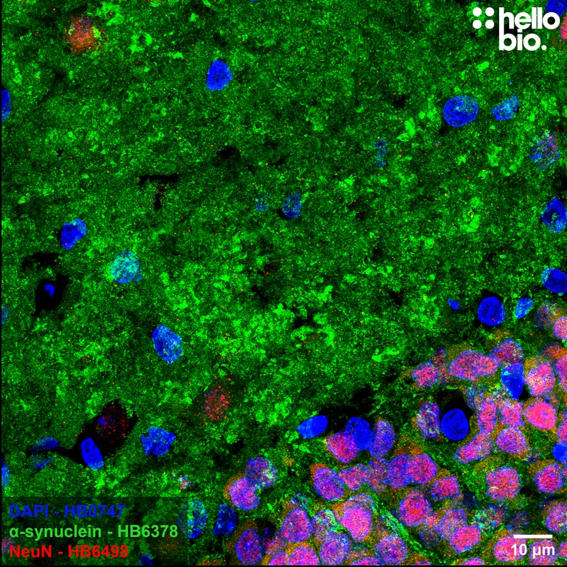 Figure 3. α-Synuclein staining in rat dentate gyrus