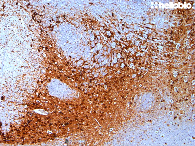 Figure 4. Tyrosine hydroxylase staining of dopaminergic nuclei in rat midbrain visualized using biotin-streptavidin detection.