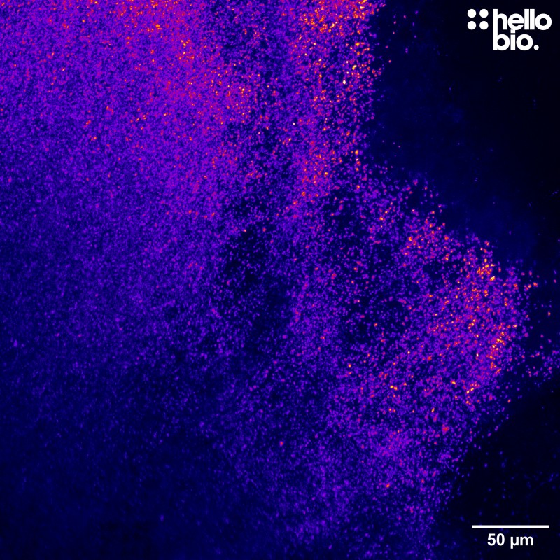 Figure 4. Cleared mouse brain segment stained for tyrosine hydroxylase showing dopaminergic neuron projections.