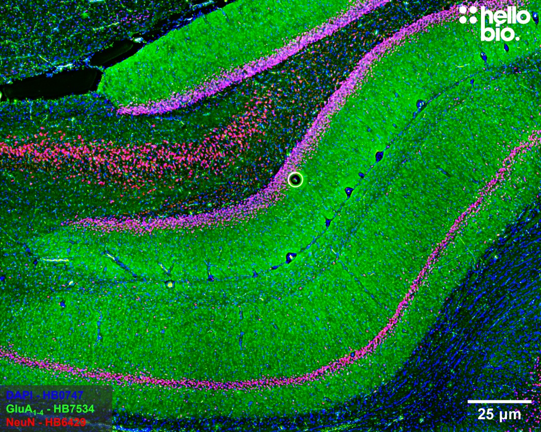 Figure 10. AMPA receptor expression in rat dentate gyrus and CA1 mapped using HB7534.