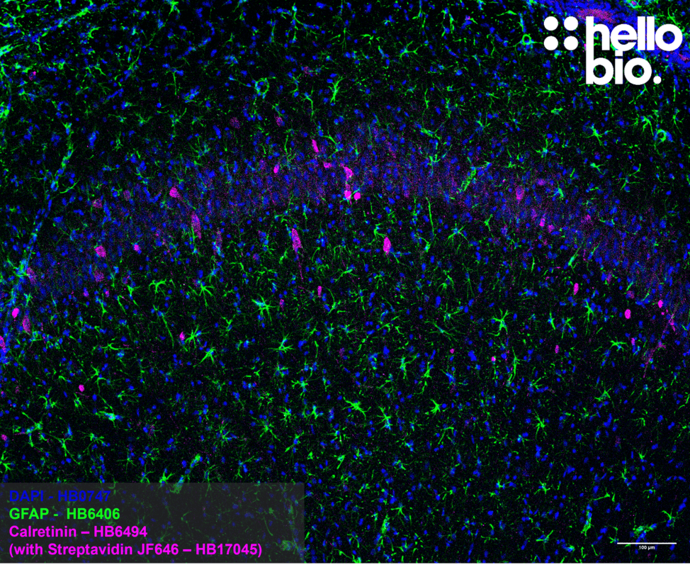 Figure 1. Calretinin positive interneurons and astrocytes in the rat hippocampus.