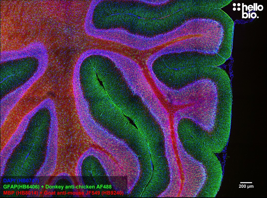 Figure 5. MBP staining in rat cerebellum using HB9240 Goat Anti-Mouse IgG H&L (Janelia Fluor® 549) preadsorbed secondary antibody.