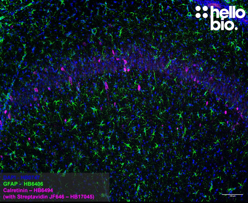 Figure 4. Calretinin positive interneurons and astrocytes in the rat hippocampus.