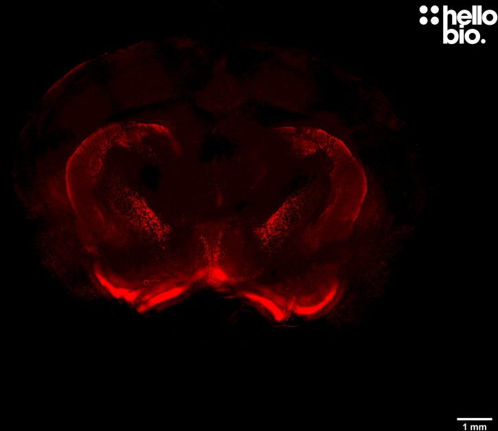 Figure 5. Cleared mouse brain segment stained for tyrosine hydroxylase showing dopaminergic neurons in the striatum