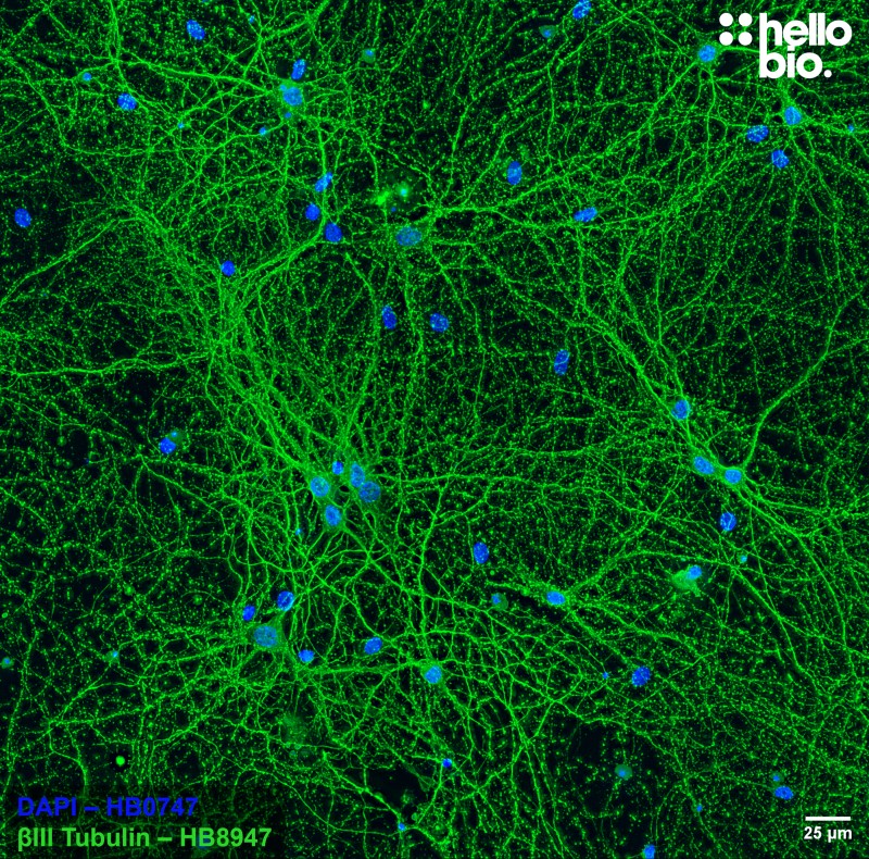 Figure 7. βIII tubulin staining with HB8947 of cultured rat hippocampal neurons.