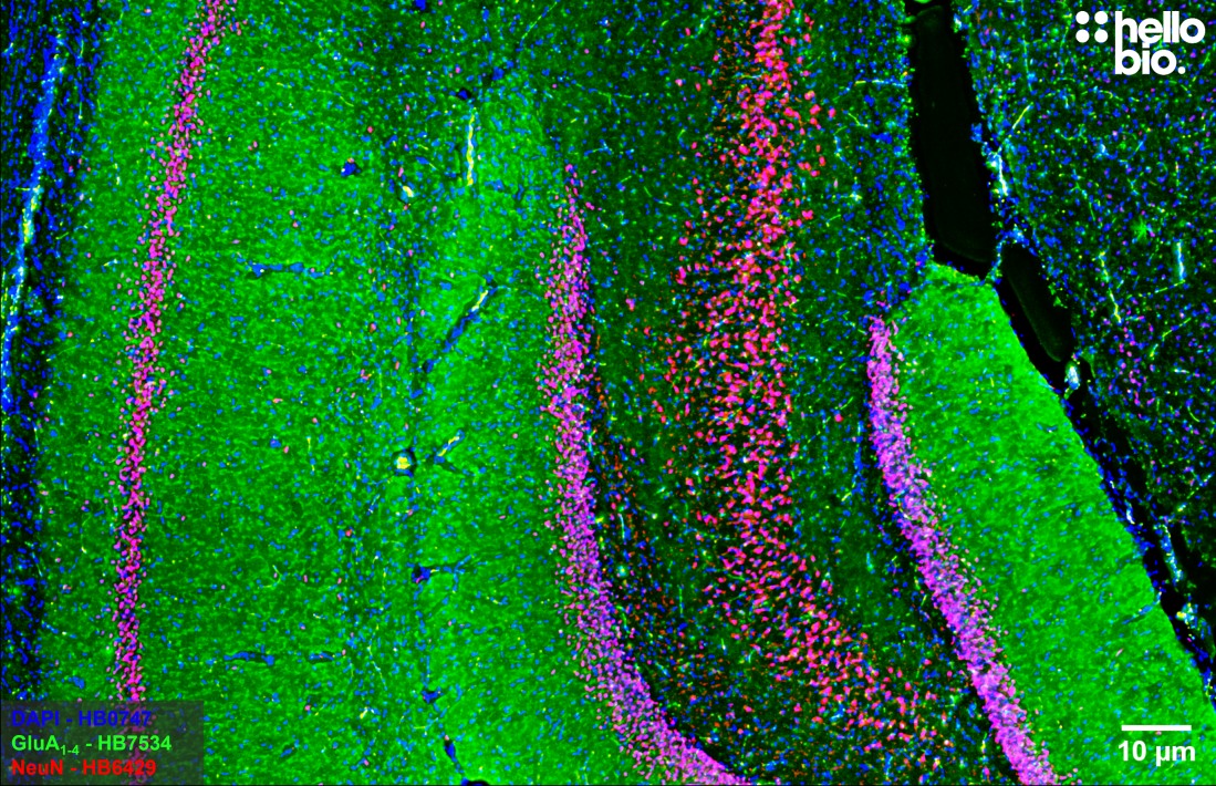 Figure 2. AMPA receptor expression in rat dentate gyrus and CA1 mapped using HB7534.