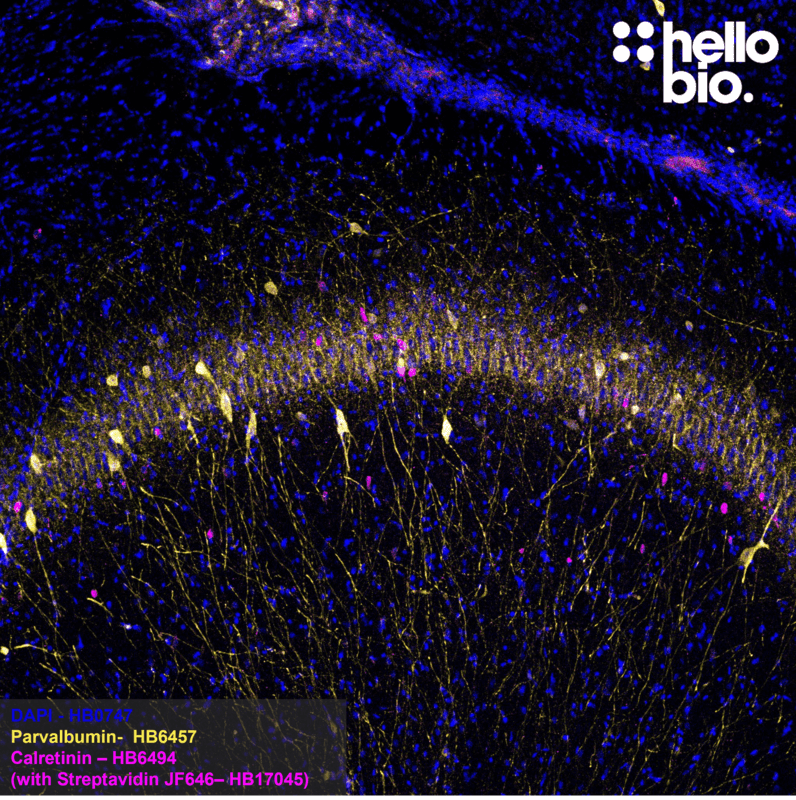 Figure 3. Calretinin and Parvalbumin expression in rat hippocampus.