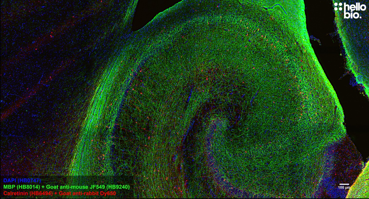 Figure 6. MBP staining in rat hippocampus using HB9240 Goat Anti-Mouse IgG H&L (Janelia Fluor® 549) preadsorbed secondary antibody.