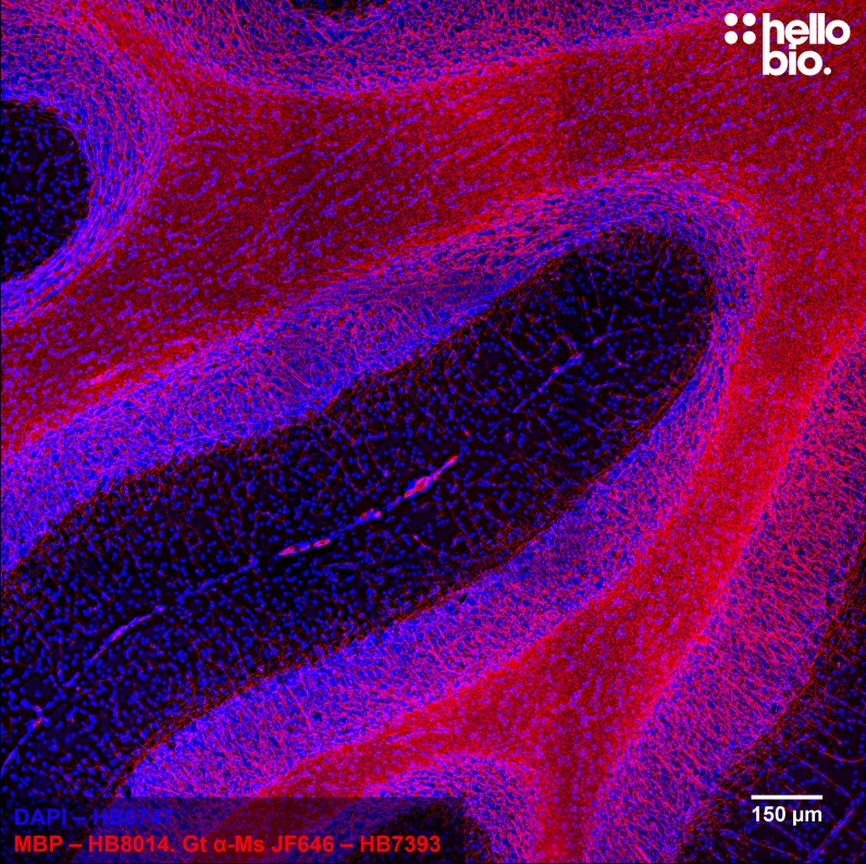 Figure 7. Cerebellum stained for Myelin basic protein (MBP) using HB8014 and HB7393 Goat Anti-Mouse H&L (Janelia Fluor® 646).