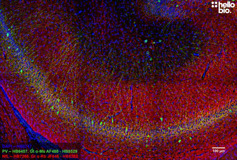 Figure 7. Neurofilament L and Parvalbumin staining in rat hippocampus using HB8283 Goat Anti-Rabbit H&L (Janelia Fluor® 646) and HB8529 Goat Anti-Mouse H&L (AF488)