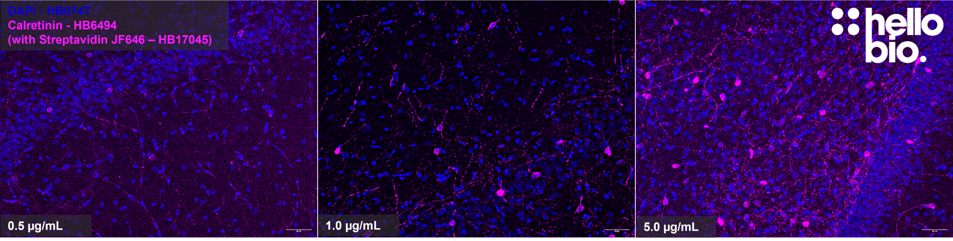 Figure 5. Concentration response of HB17046 staining in rat hippocampus.