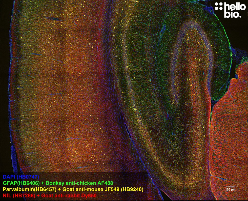 Figure 7. Parvalbumin staining in rat hippocampus and cortex using HB9240 Goat Anti-Mouse IgG H&L (Janelia Fluor® 549) preadsorbed secondary antibody.