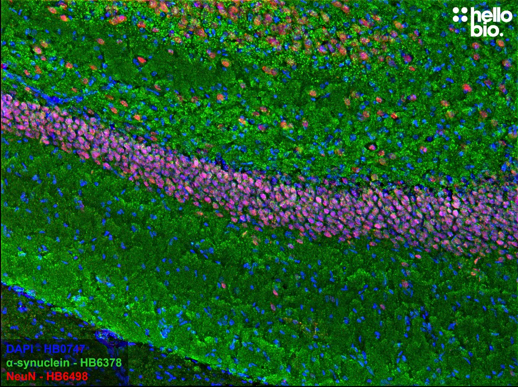 Figure 8. α-Synuclein staining in rat hippocampal CA1