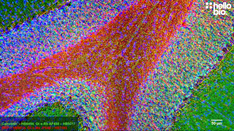 Figure 8. Rat cerebellum stained for MBP (HB8014) and Calretinin (HB6494) using HB7393 Goat Anti-Mouse H&L (Janelia Fluor® 646) and HB9317 Goat Anti-Rabbit H&L (AF488).