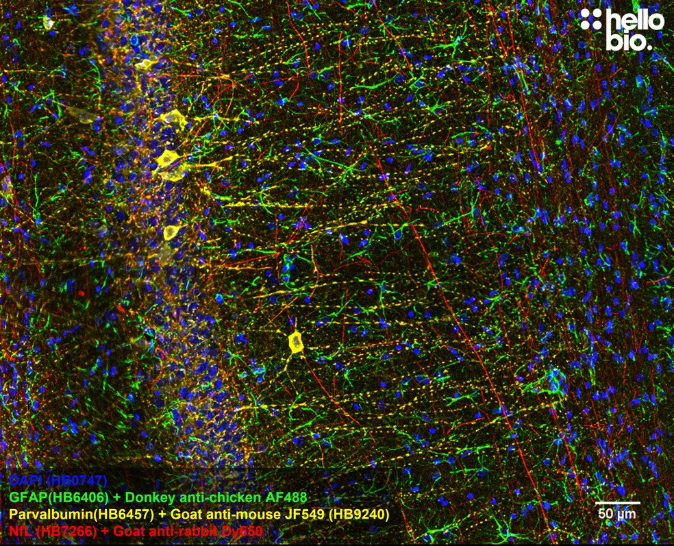 Figure 8. Parvalbumin staining in rat CA1 using HB9240 Goat Anti-Mouse IgG H&L (Janelia Fluor® 549) preadsorbed secondary antibody.