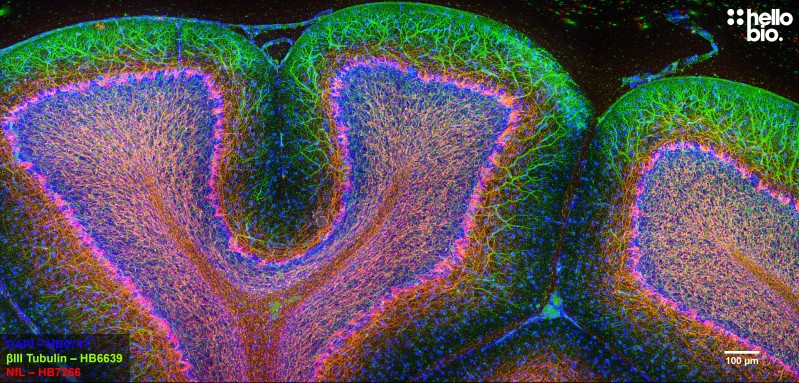 Figure 7. βIII-tubulin and Neurofilament light staining in rat cerebellum. Mounted using MightyMount<sup>TM</sup> Antifade Fluorescence Mounting Medium (aqueous).