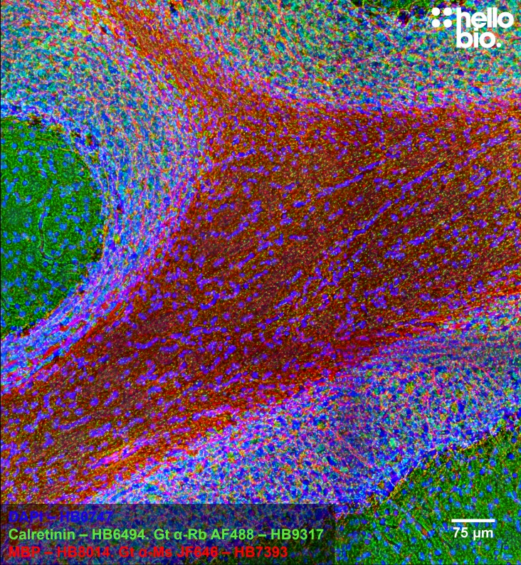 Figure 5. Rat cerebellum stained for MBP (HB8014) and Calretinin (HB6494) using HB7393 Goat Anti-Mouse H&L (Janelia Fluor® 646) and HB9317 Goat Anti-Rabbit H&L (AF488).