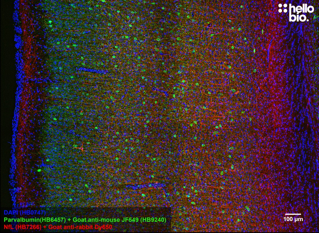 Figure 9. Parvalbumin staining in rat cortex using HB9240 Goat Anti-Mouse IgG H&L (Janelia Fluor® 549) preadsorbed secondary antibody.