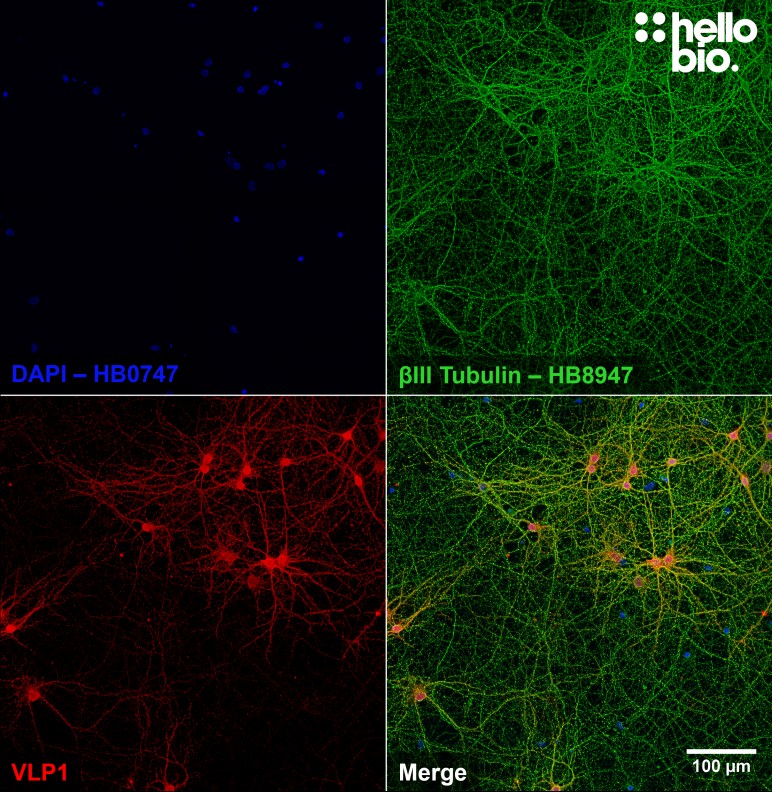 Figure 3. Cultured neurons expressing both βIII tubulin and VLP1.