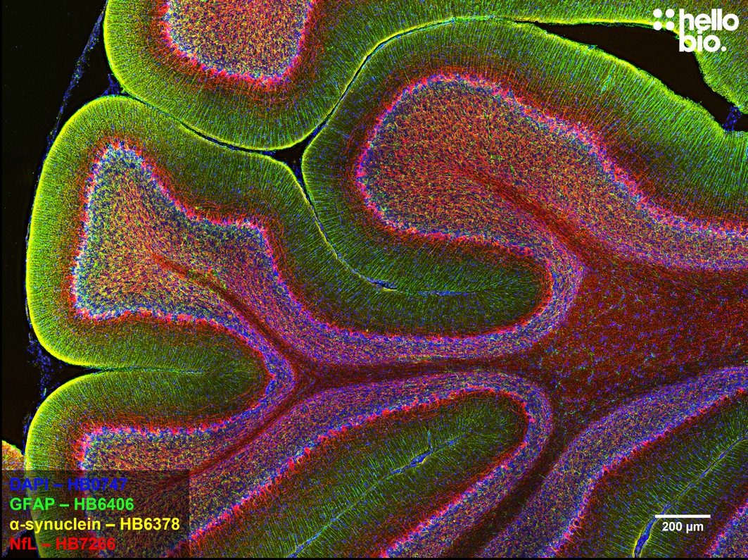 Figure 1. GFAP, alpha-synuclein and Neurofilament light staining in rat cerebellum. Mounted using MightyMount<sup>TM</sup> Antifade Fluorescence Mounting Medium (hardset).