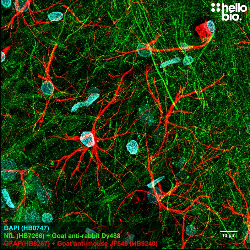 Figure 1. GFAP staining using HB9240 Goat Anti-Mouse IgG H&L (Janelia Fluor® 549) preadsorbed secondary antibody.