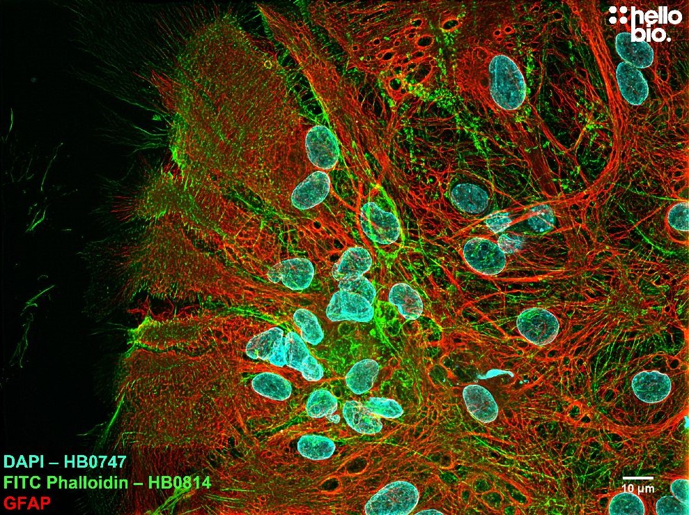 Figure 3. FITC Phalloidin, GFAP and DAPI co- staining in neuronal cell culture