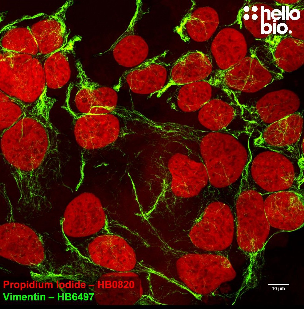 Figure1. Vimentin and Propidium lodide co-staining in HEK293T cells