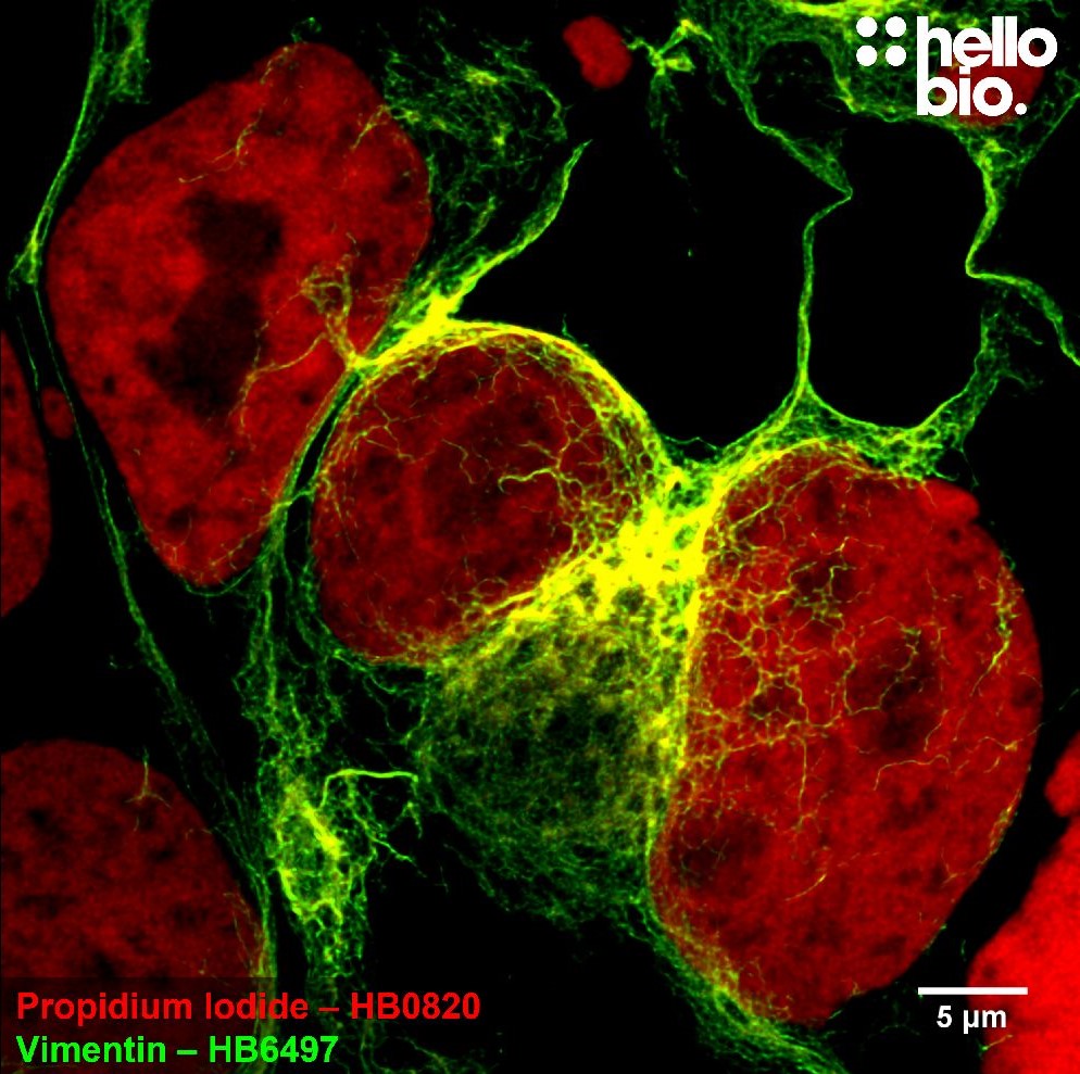 Figure 3. Vimentin and Propidium lodide co-staining in HEK293T cells