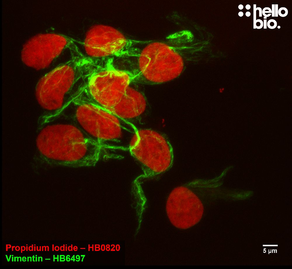 Figure 4. Vimentin and Propidium lodide co-staining in HEK293T cells